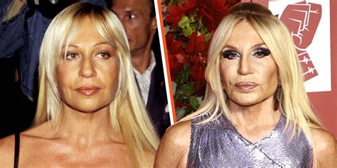 madame versace chirurgie|donatella versace before surgery.